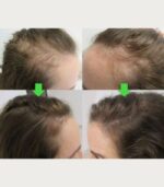 Ser Biotin - imagine 2